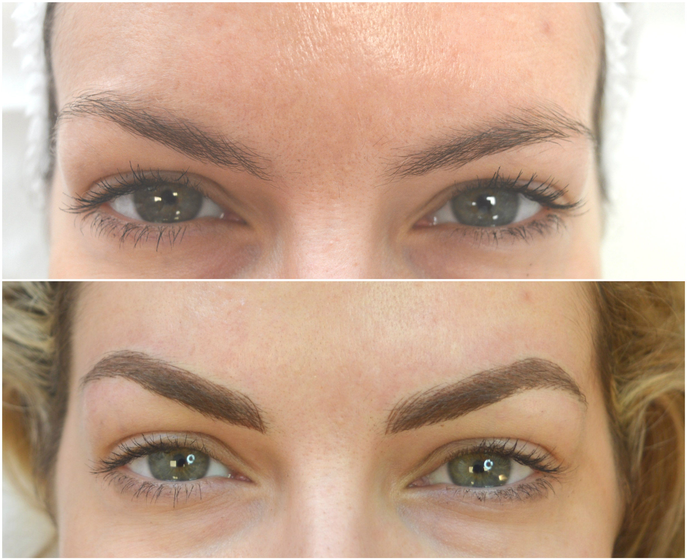 Dimitroglou collage before _after