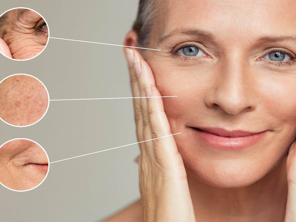 Κοντινό σε γυναικείο πρόσωπο με σημειωμένα τα σημεία για πλαστική επέμβαση.