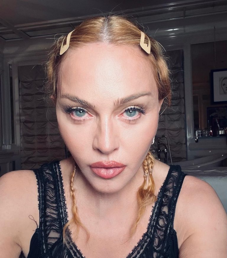 Madonna με πατημένα μαλλιά και τσιμπιδάκια