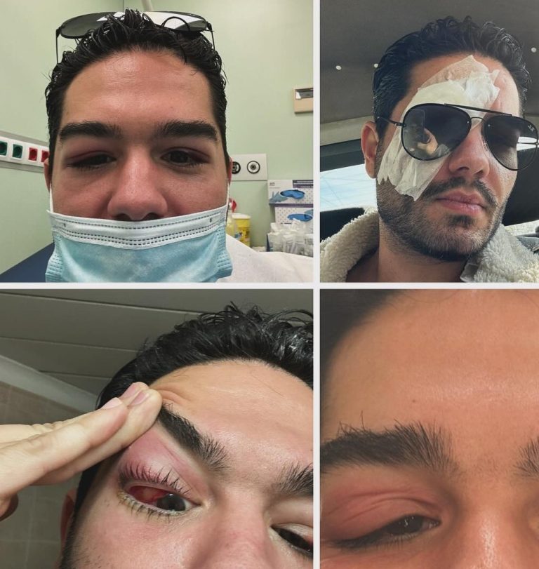 Η περιπέτεια υγείας του Χρήστου Μάστορα