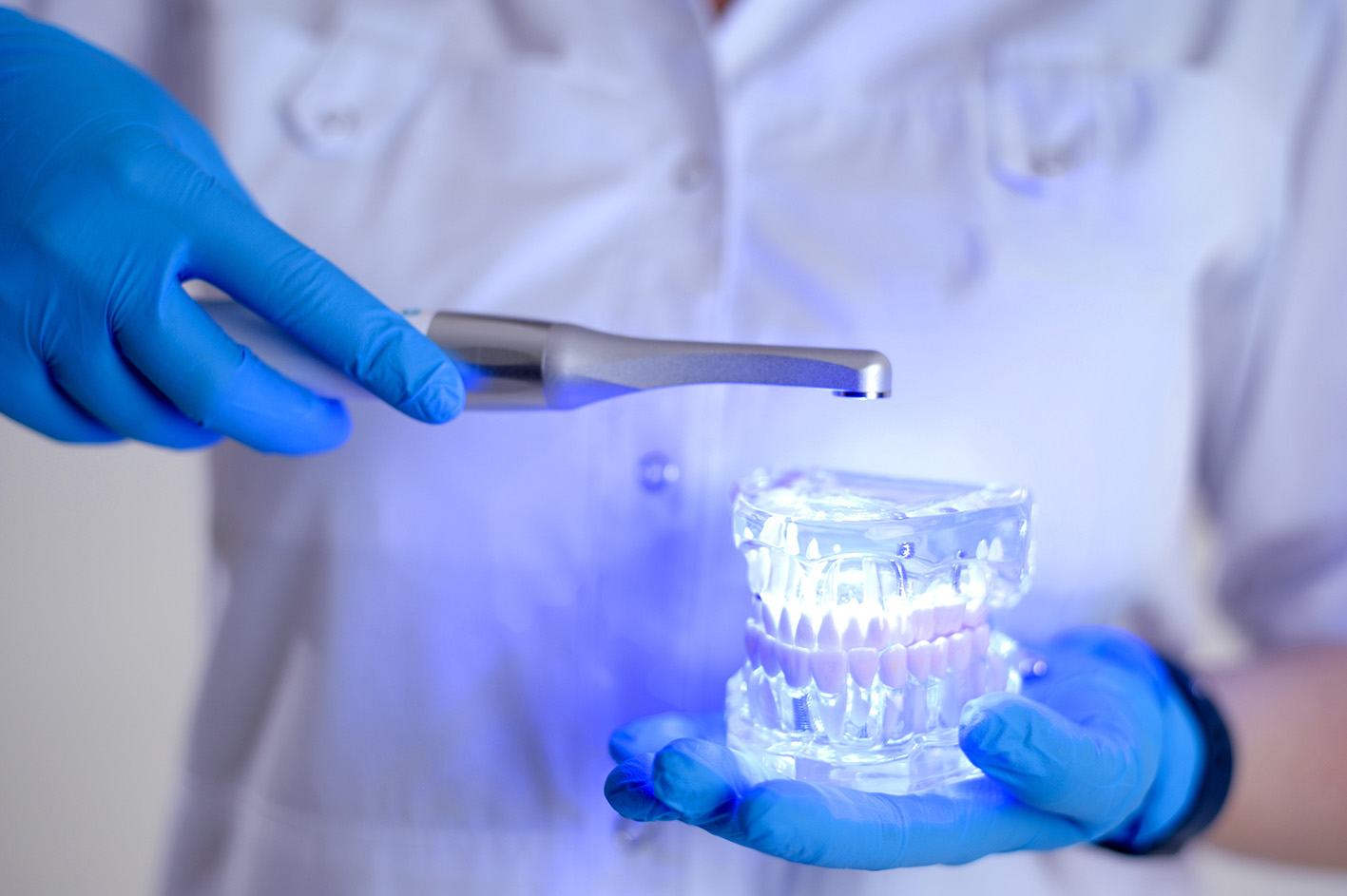 Άσπρισμα δοντιών