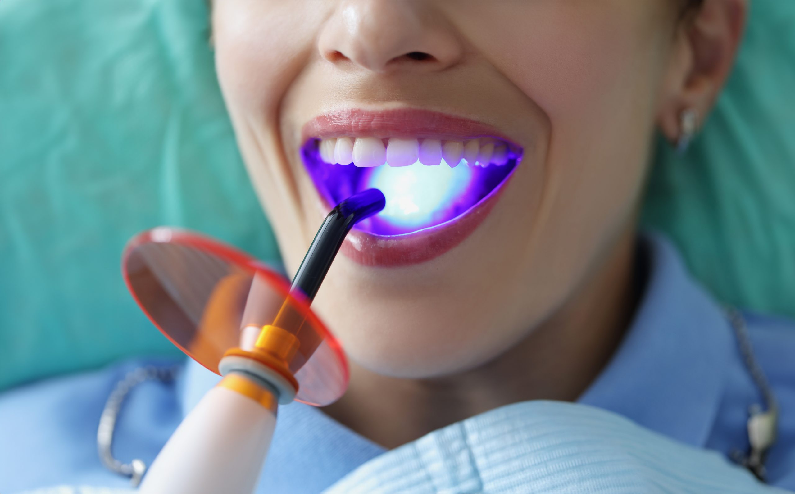 Γυναίκα στον οδοντίατρο για άσπρισμα δοντιών