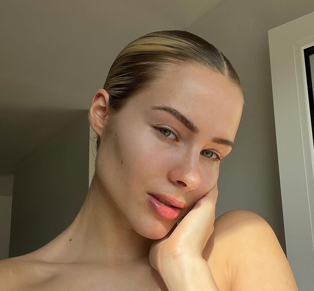 χημικό peeling