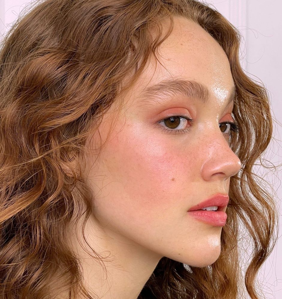 μαύροι κύκλοι εκ γενετής