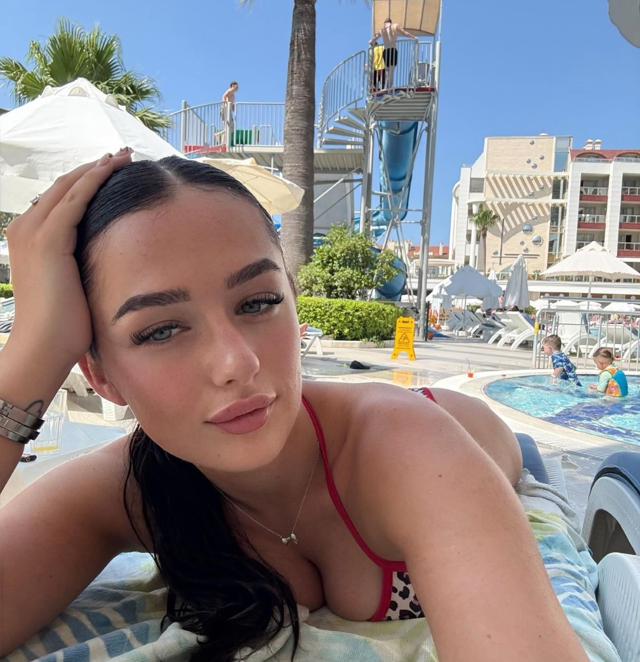 κοπέλα στη σκιά προσέχοντας το έγκαυμα