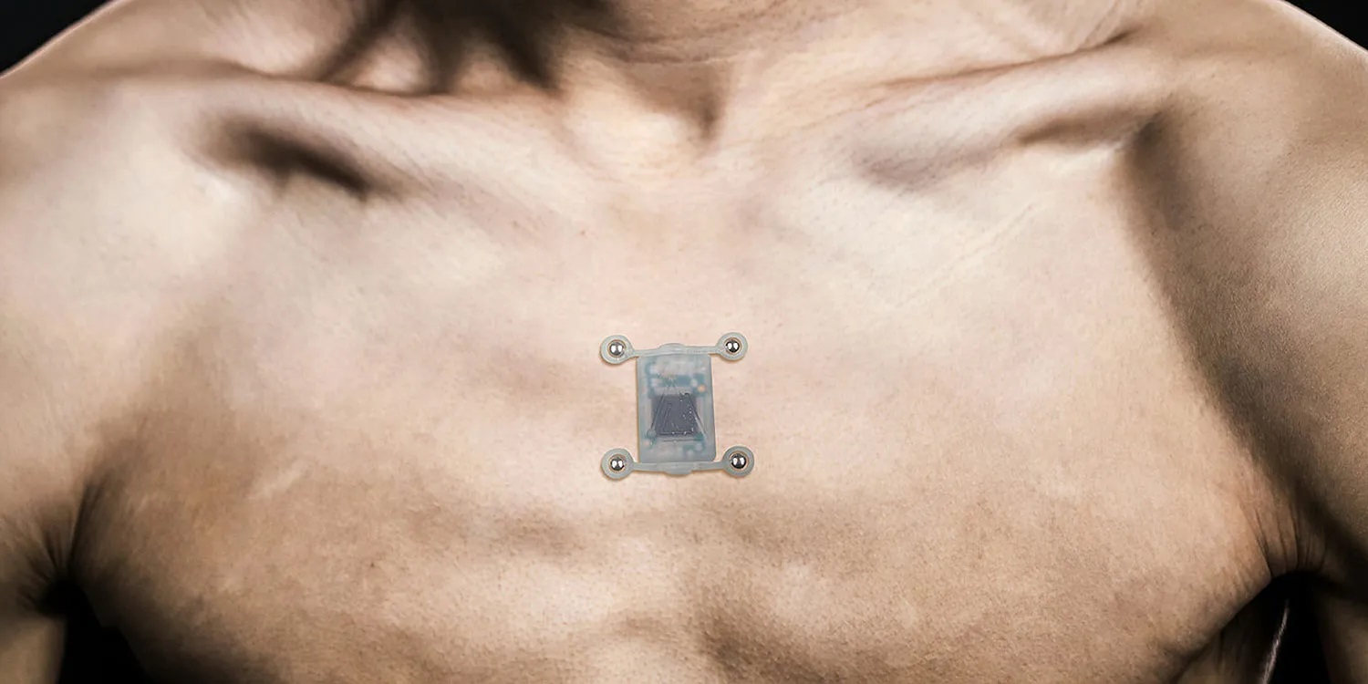 H συσκευή Northsense, που δημιούργησε ο Liviu Babitz, η οποία του επέτρεπε να αντιλαμβάνεται πότε ήταν στραμμένος προς τον Βόρειο Μαγνητικό Πόλο