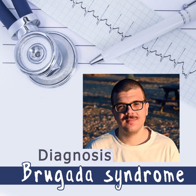 Διάγνωση συνδρόμου Brugada και ο Μιχάλης Γρίβας
