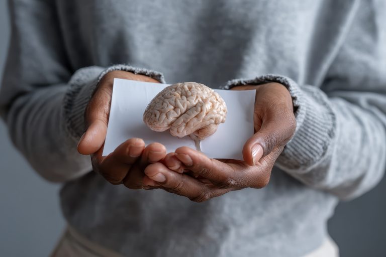 Αλτσχάιμερ