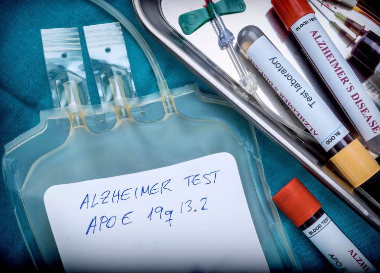 Εξέταση αίματος για το Αλτσχάιμερ