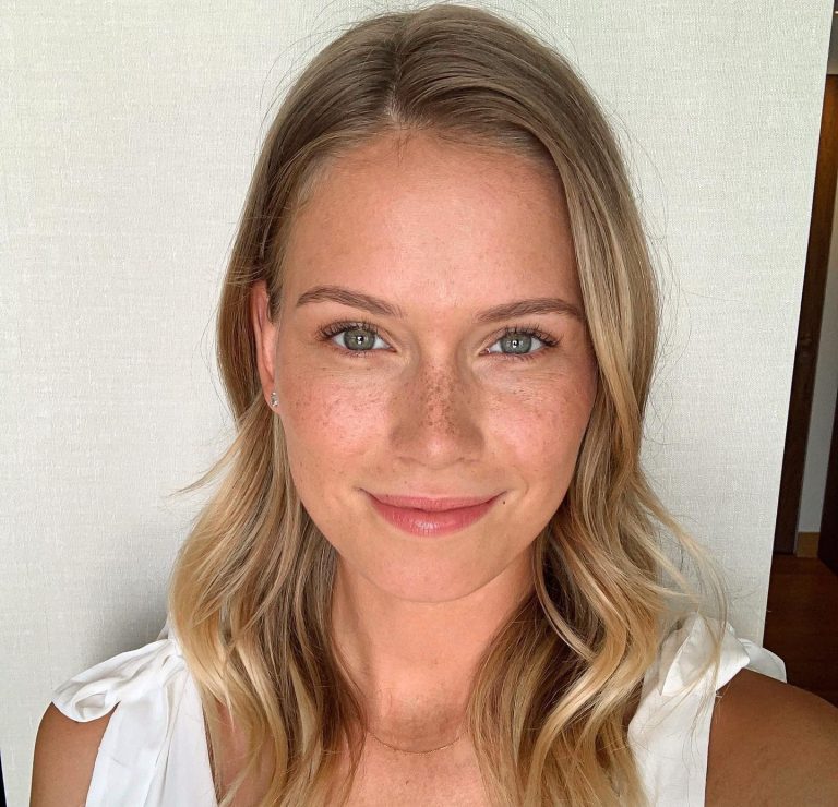 Κοπέλα με φακίδες