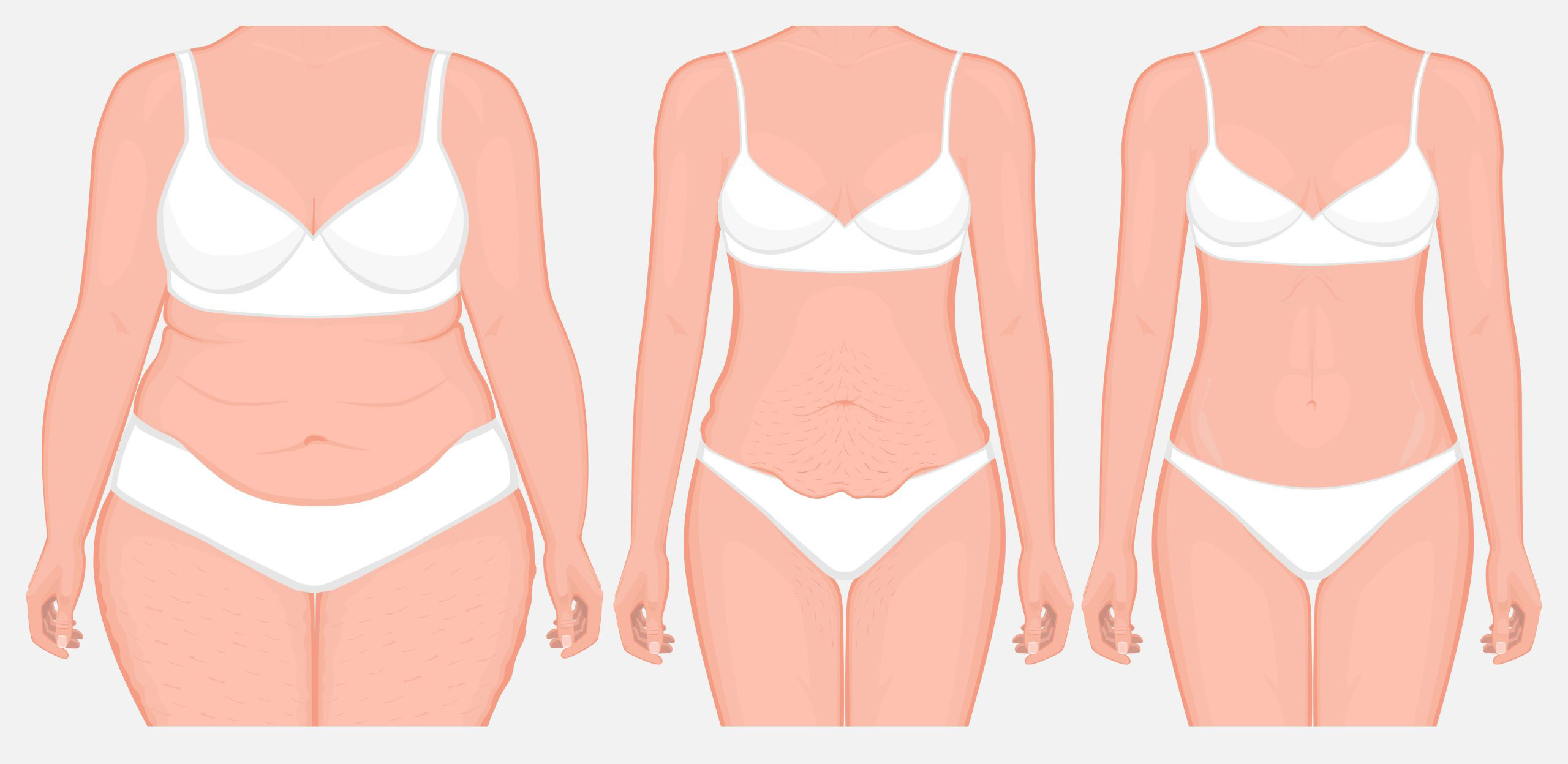 Διαφορετικά είδη σώματος. Ιδανικό βάρος