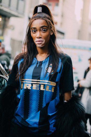 Winnie Harlow (Photo by Melodie Jeng/Getty Images/Ideal Images)