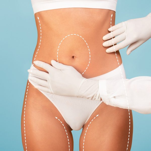 plastic surgery belly 194496603_fb-image